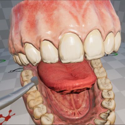 dental2
